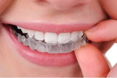 Orthodontics